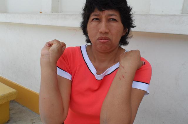 La médico María Mejía llegó a laborar al Hospital de Casma resultó con heridas.