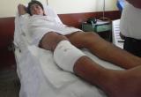 Agricultor fue baleado por su cuñado porque le reclamó por constantes agresiones a su hermana.