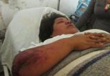 Patricia Lozada Villanueva de 28 años se encuentra internada en Hospital La Caleta.