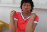 La médico María Mejía llegó a laborar al Hospital de Casma resultó con heridas.
