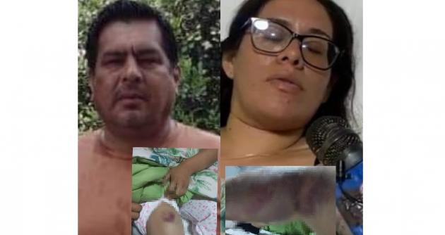 (Foto cortesía PNP)