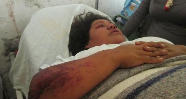 Patricia Lozada Villanueva de 28 años se encuentra internada en Hospital La Caleta.