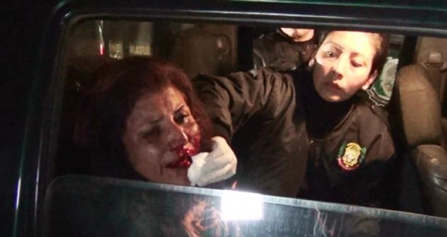 Violencia contra la mujer persiste. Ahora el caso de una psicóloga.