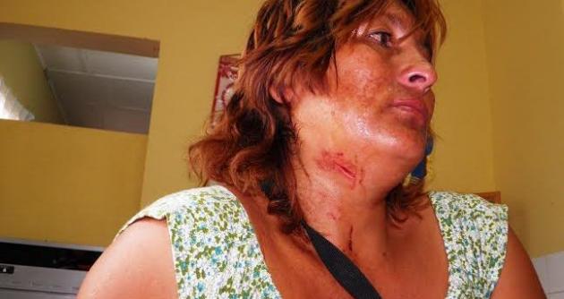 Gabriela Haro tiene profundos cortes en el cuello, pecho y en las manos.