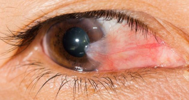 (Foto fuente Shepard Eye Center)