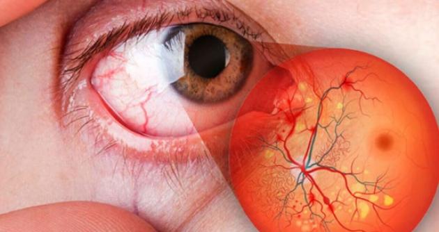 (Foto referencial Internet)