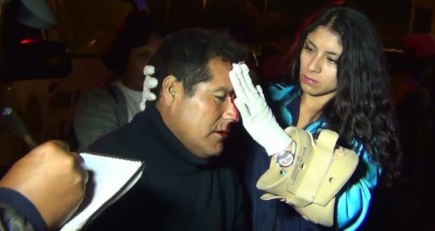 (Foto: cortesía Serenazgo MDNCH)