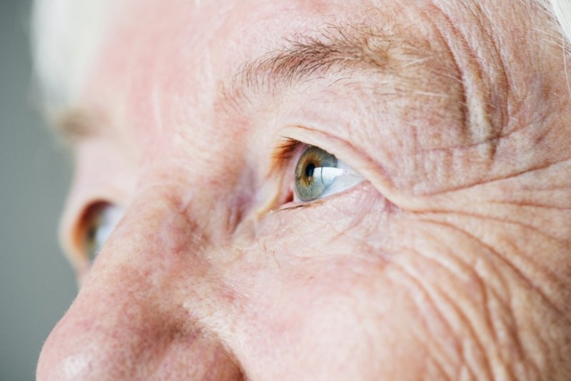 ¿Qué es el glaucoma? Causas, síntomas, diagnóstico, tratamiento
