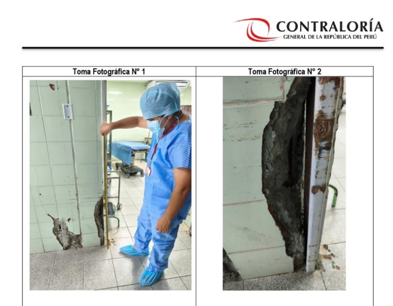 Contraloría emite informe sobre prestación de servicios del centro quirúrgico del Hospital La Caleta