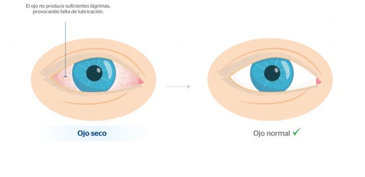 ¿Cómo afecta el calor extremo a nuestra visión?