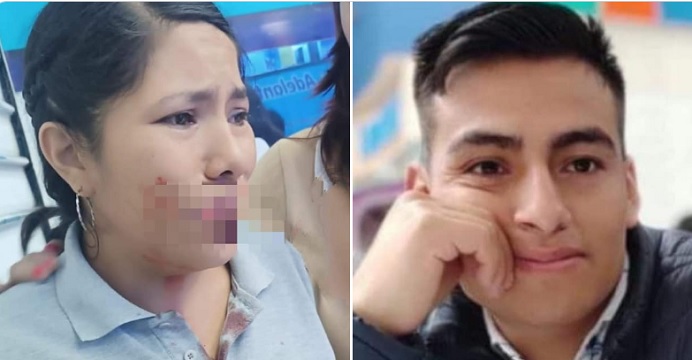 Huarmey: sujeto muerde y arranca un pedazo de labio a su pareja en medio de discusión