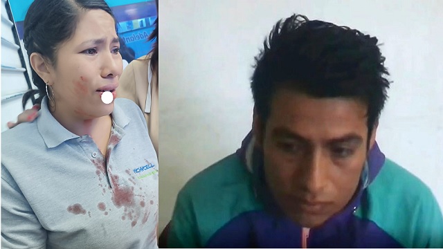 Sujeto que arrancó un pedazo de labio a su conviviente en Huarmey irá ocho meses a prisión