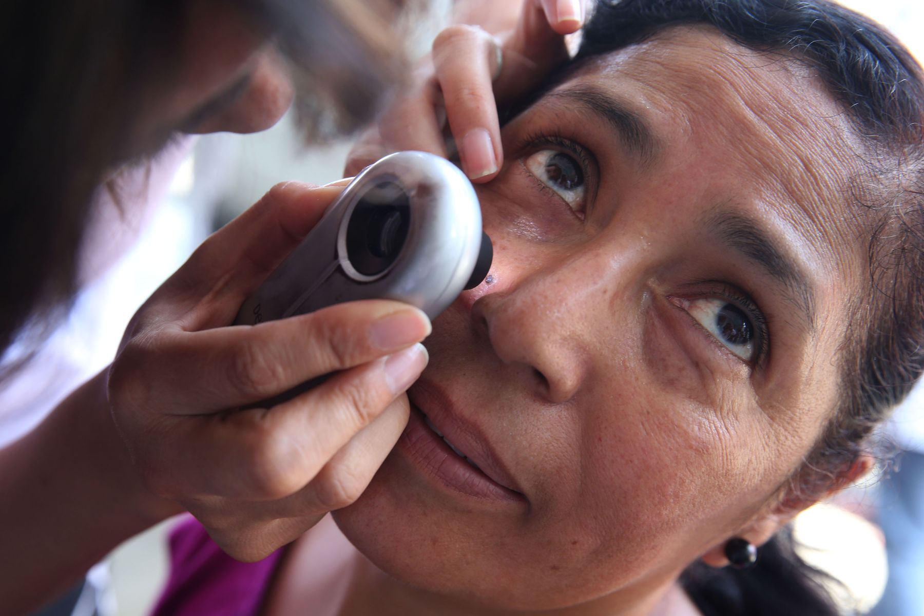 Chimbote: hospital regional detecta hasta nueve casos de cáncer a la piel