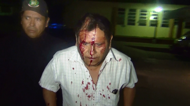 Nuevo Chimbote: adolescente al volante chocó con taxi dejando herido al chofer