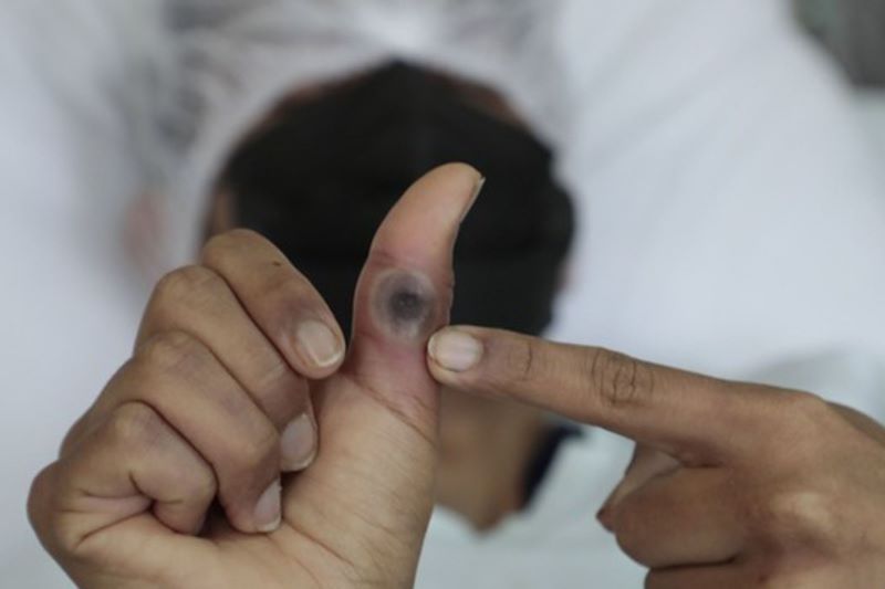 ¿Sabe cómo prevenir la viruela del mono?, el Minsa brinda estas recomendaciones