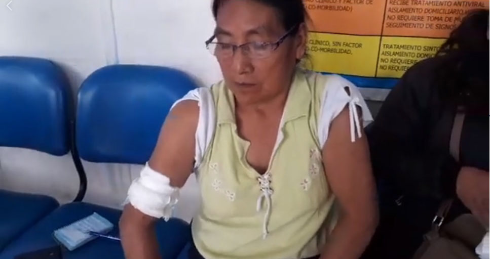 Nuevo Chimbote: perro pitbull ataca a mujer de 65 años en Tierra Prometida