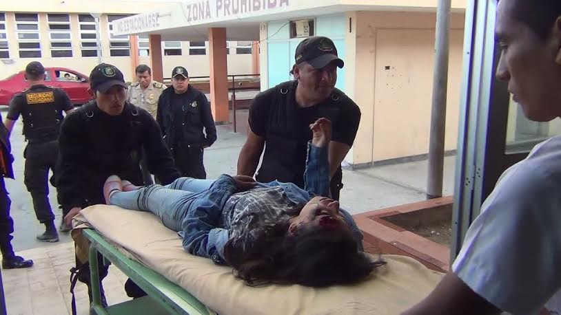 Nuevo Chimbote: Terrible accidente deja gravemente herida a una menor de edad  
