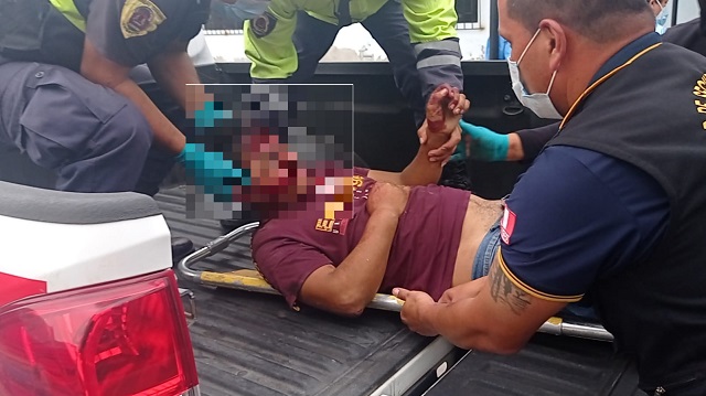Chimbote: mototaxista sufre grave accidente al despistarse en la carretera de penetración a Cambio Puente