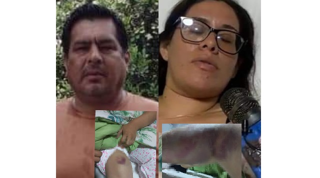 Ordenan 9 meses de prisión preventiva contra sujeto que golpeó a su pareja en Casma