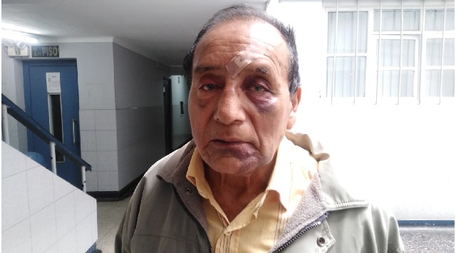 Sujeto casi mata a anciano de un ladrillazo en la cabeza porque le cobró deuda de 36 soles  