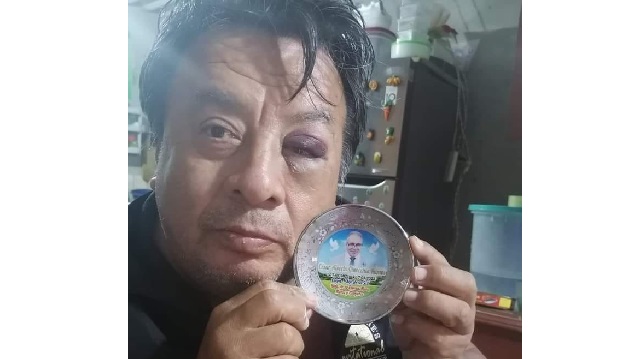 Conocido presentador de eventos cayó de escenario de 4 metros de altura en Chimbote