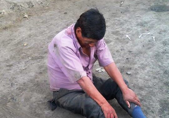 Chimbote: Delincuentes asaltan y encima golpean a poblador en “Magdalena Nueva”
