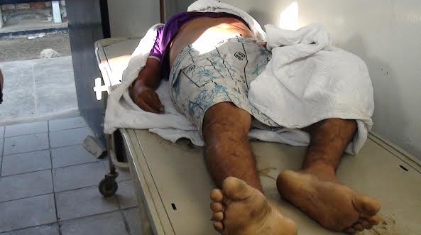 Asesinan a sujeto de un balazo en el ojo en el pueblo joven San Pedro