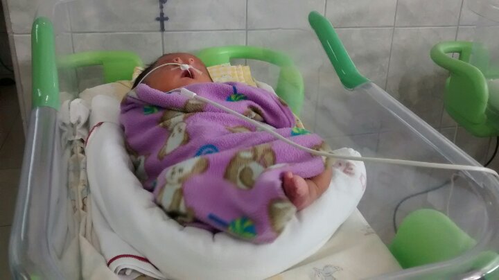 Chimbote: bebe que nació con dos narices se encuentra internado en hospital III de EsSalud 