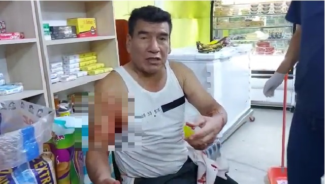 Dueño de bodega es atacado con picos de botella por una desconocida en Nuevo Chimbote