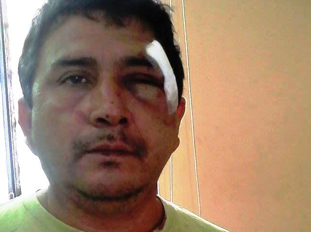 Brigadier de la Policía es atacado a pedradas por cuatro sujetos que instantes después fueron atrapados en Chimbote