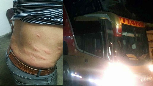 Pasajeros obligan a detener bus infectado por chinches en Chimbote, sufrieron picaduras