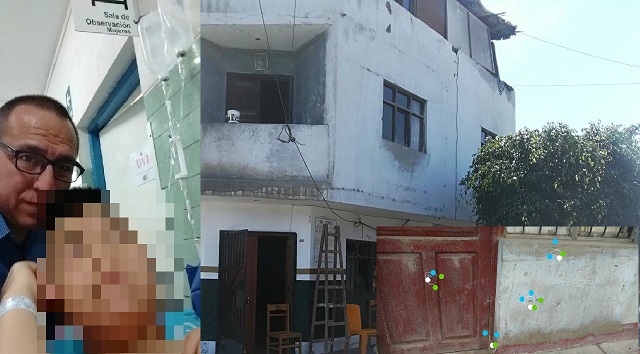 Excandidato a la alcaldía de Chimbote sufrió grave atentado en su vivienda y hieren a su hijo de 11 años