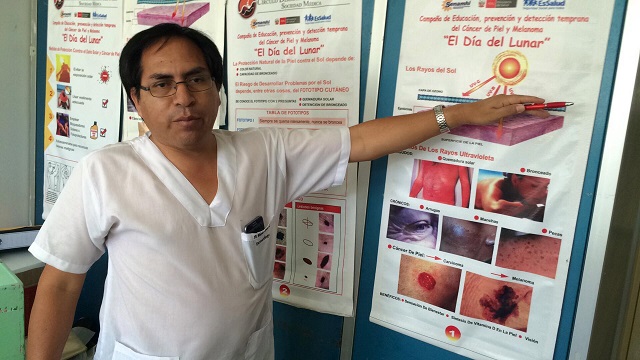 Se registran 7 casos de cáncer a la piel en Nuevo Chimbote, especialista recomienda no exponerse al sol