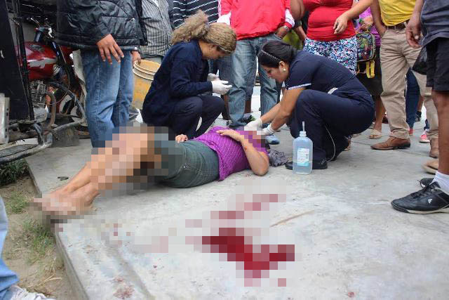 Chimbote: Madre de familia y sus dos hijos resultan heridos tras choque de combi y mototaxi