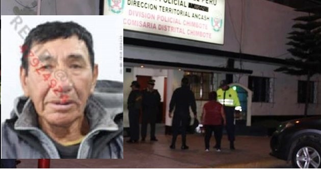 Chimbote: hombre de 67 años vuelve a golpear a su esposa pese a tener 2 órdenes de restricción