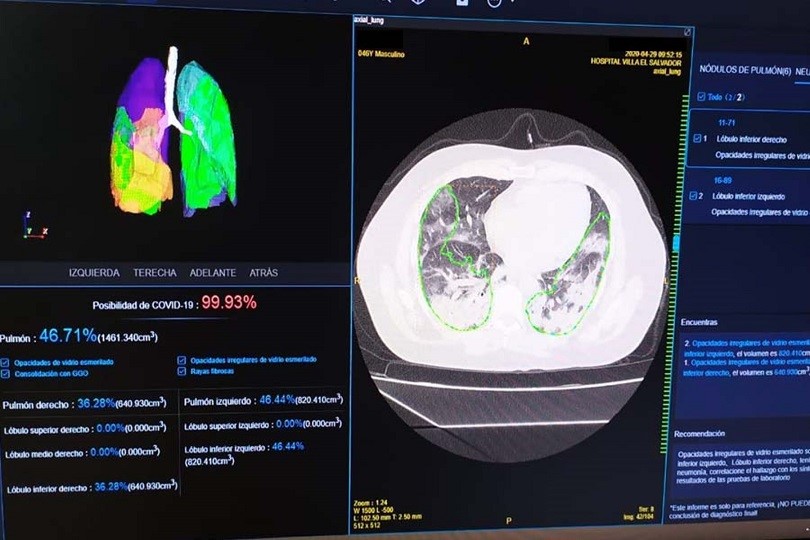 Con inteligencia artificial se detecta casos de covid-19 en 30 segundos