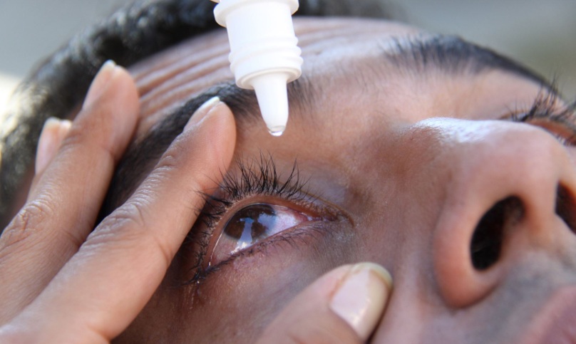 Cuidado con la conjuntivitis, advierten aumento de infecciones oculares en verano