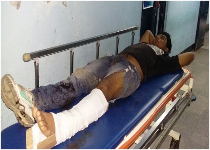 Delincuente apodado “Mudo” fue baleado en violento tiroteo con la policía en Chimbote