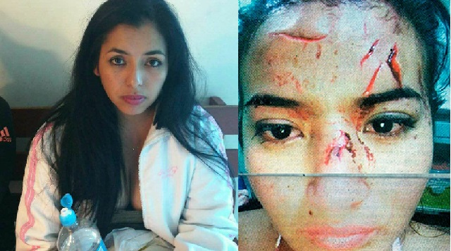 Detienen a mujer acusada de desfigurar el rostro a joven ecuatoriana en discoteca de Nuevo Chimbote