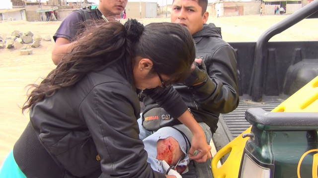 Recibió disparo en la pierna al resistir robo de su motocicleta