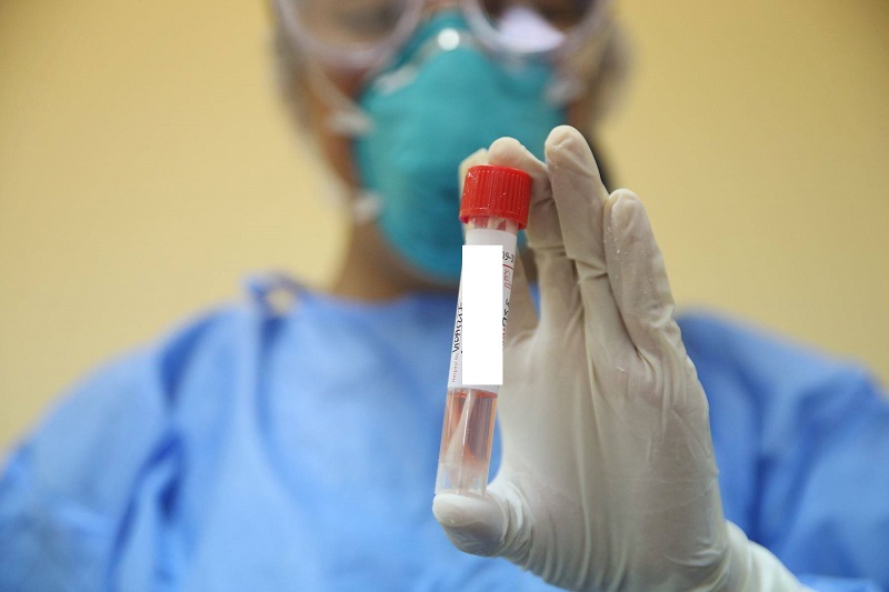 En Áncash se descarta coronavirus en 103 muestras tomadas