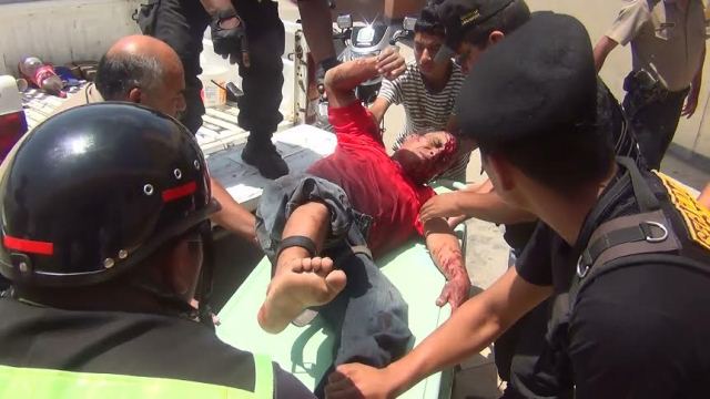 "Marcas" dejaron herido a obrero al intentar robarle a unos metros de su casa