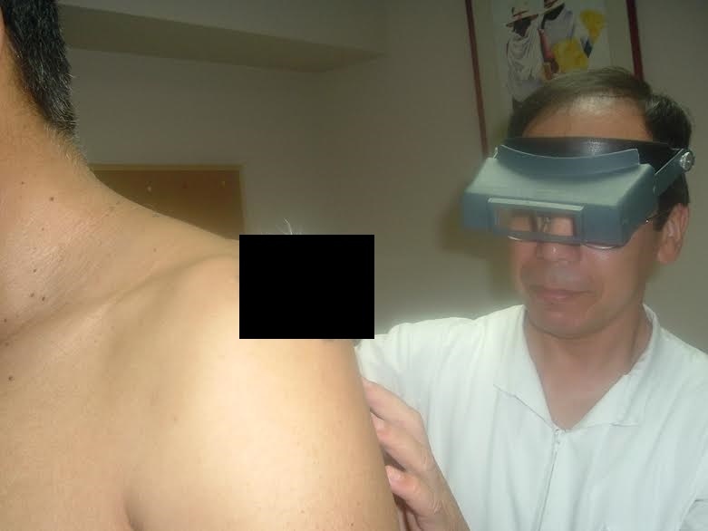 Chimbote: mañana es la campaña nacional de atención y prevención de cáncer a la piel