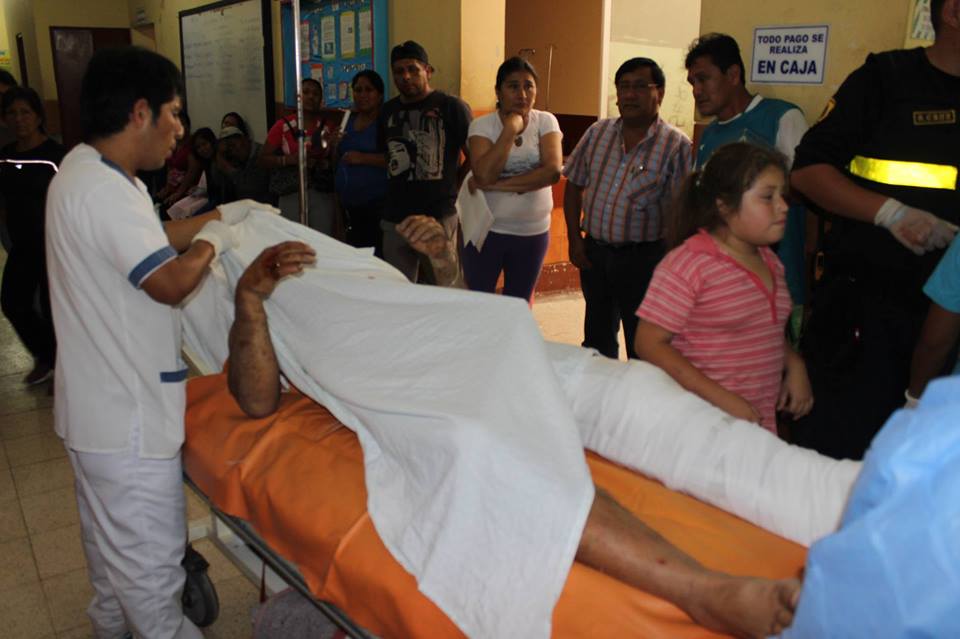 Chimbote: Explosión deja dos hombres con graves quemaduras 