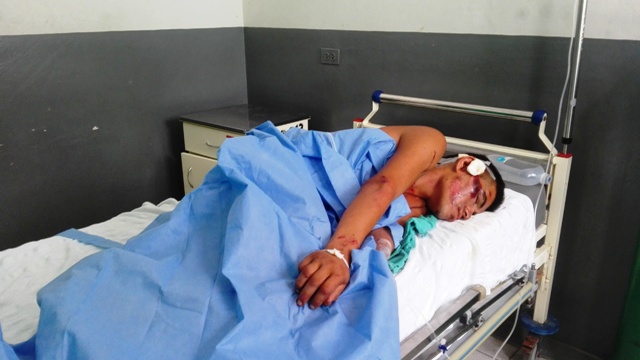 Chimbote: Chofer irresponsable arrolla a obrero y se fuga dejándolo tirado en el pavimento 