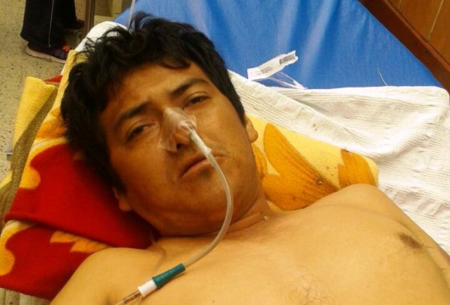 Hieren de dos balazos a agricultor en presencia de su madre en distrito de Macate