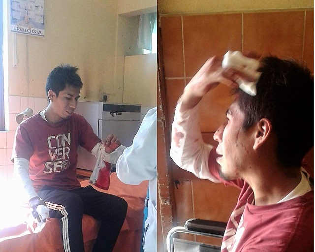 Obrero fue herido con un pico de botella en un bar de mala muerte en Chimbote, le hicieron 10 cortes