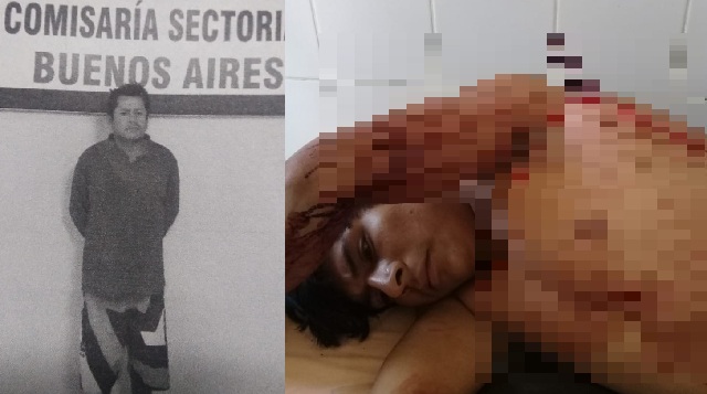 Herido llegó a la comisaría con un puñal incrustado en el tórax para denunciar a albañil en Nuevo Chimbote