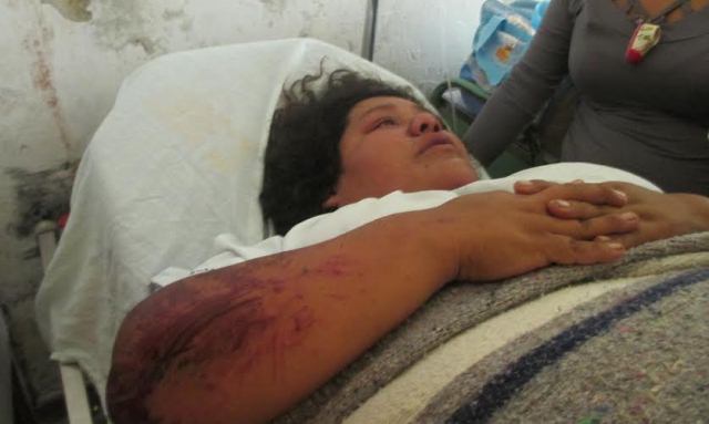 Joven gestante fue atropellada por el padre de su bebé y antes quiso estrangularla