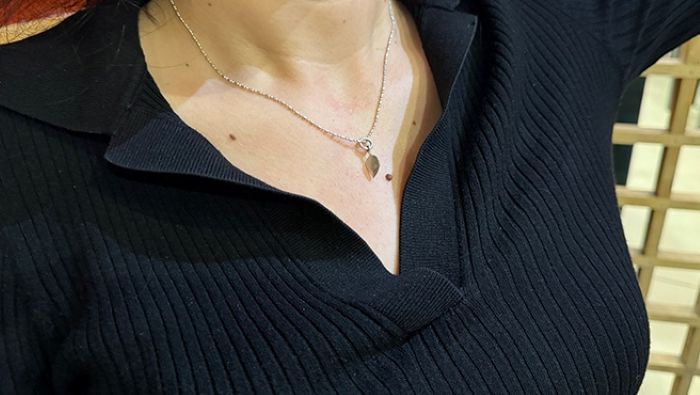 Manchas y lunares que parecen inofensivos podrían esconder un peligro que muchos ignoran